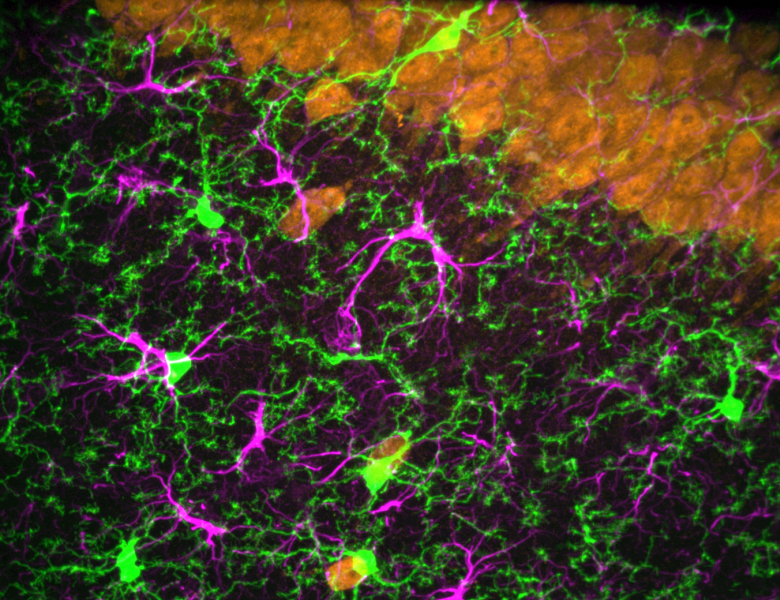 Microglies et neurones
